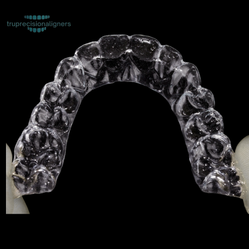 The Future of Orthodontics: Why Clear Aligners Are Taking Over